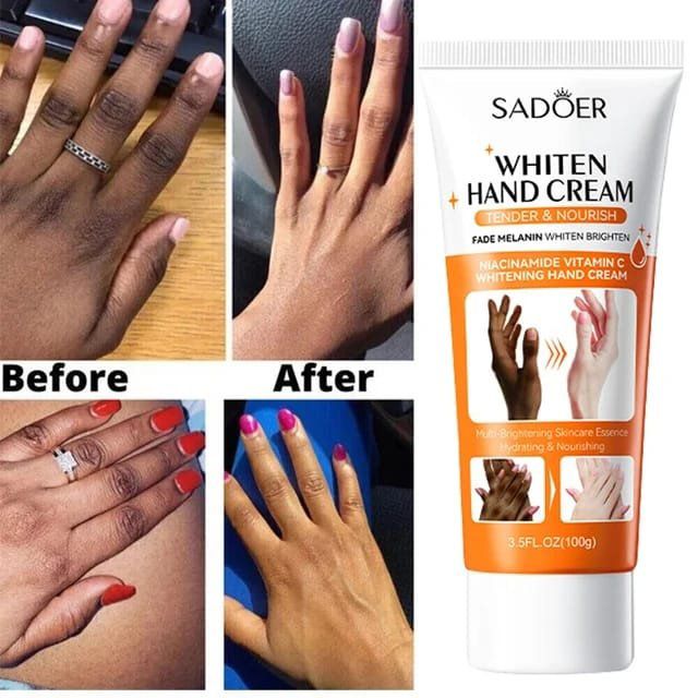 Brightening Hand Cream Dark Knuckles Fade Lightening Elbows Knee Fade Stains Improve Dry Crack Moisturizing Hand Cream