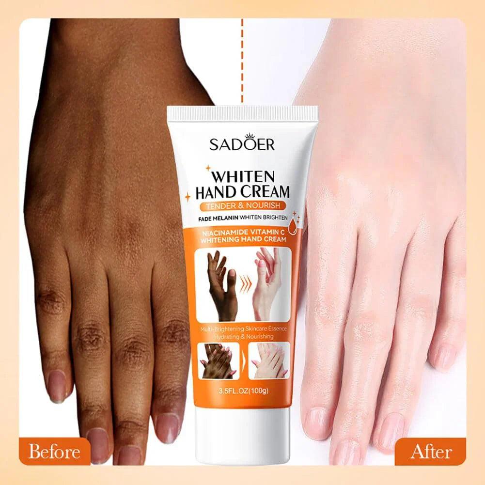 Brightening Hand Cream Dark Knuckles Fade Lightening Elbows Knee Fade Stains Improve Dry Crack Moisturizing Hand Cream