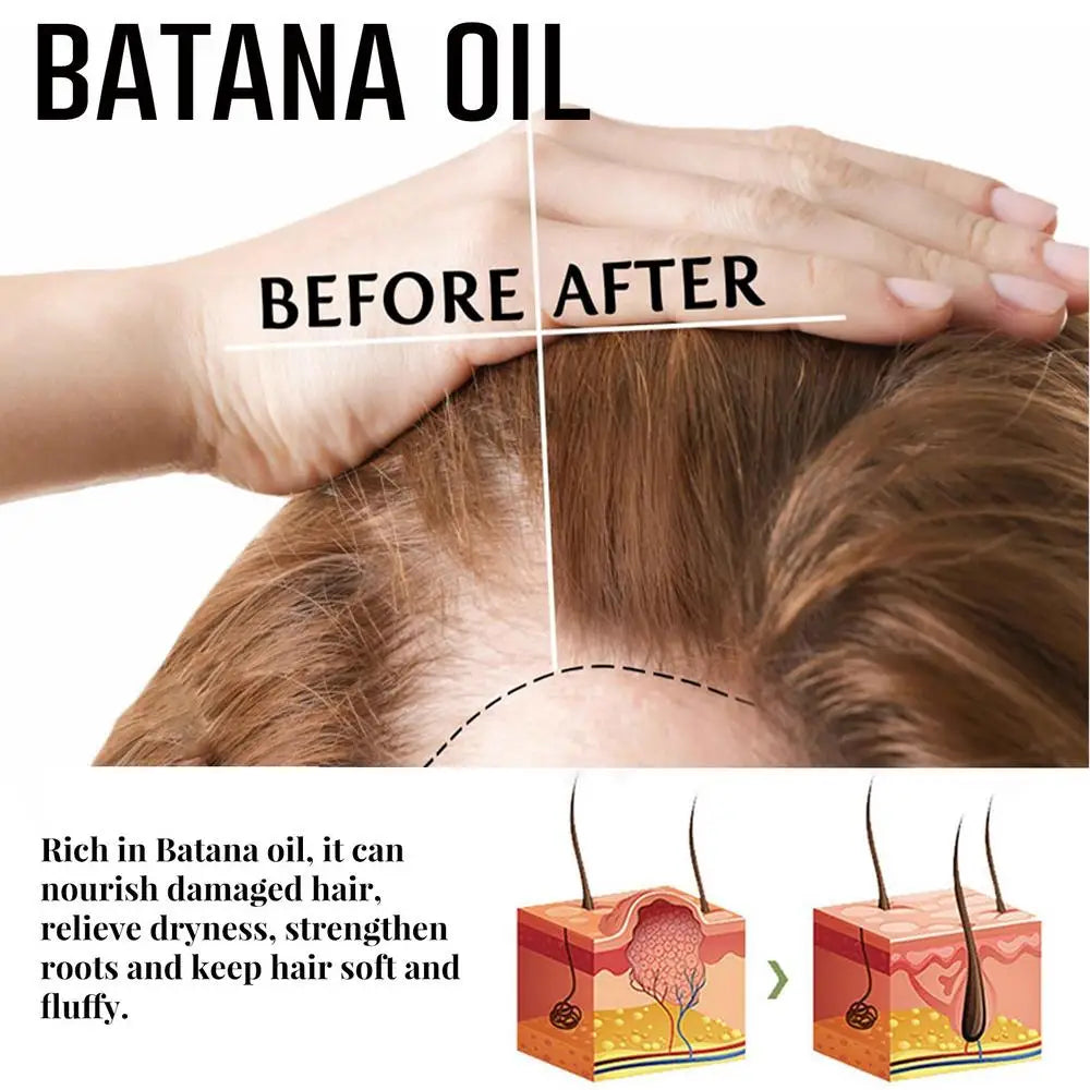 Natural Pure Batana Oil For Hair Growth Batana Oil Hair Oil Hair Loss Organic Batana Oil Hair Growth For Black Men & Women