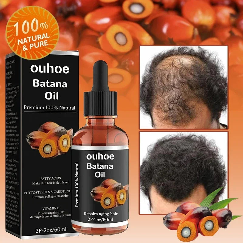 Natural Pure Batana Oil For Hair Growth Batana Oil Hair Oil Hair Loss Organic Batana Oil Hair Growth For Black Men & Women