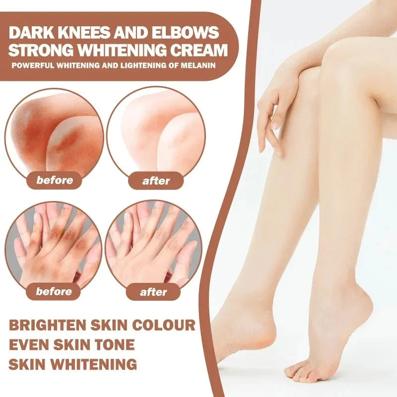 Dark Knuckles Whitening Serum Remover Get Rid of Dark Knees Dark Knuckle Elbow Cream Moisturizing Brighten Skin Tone Care