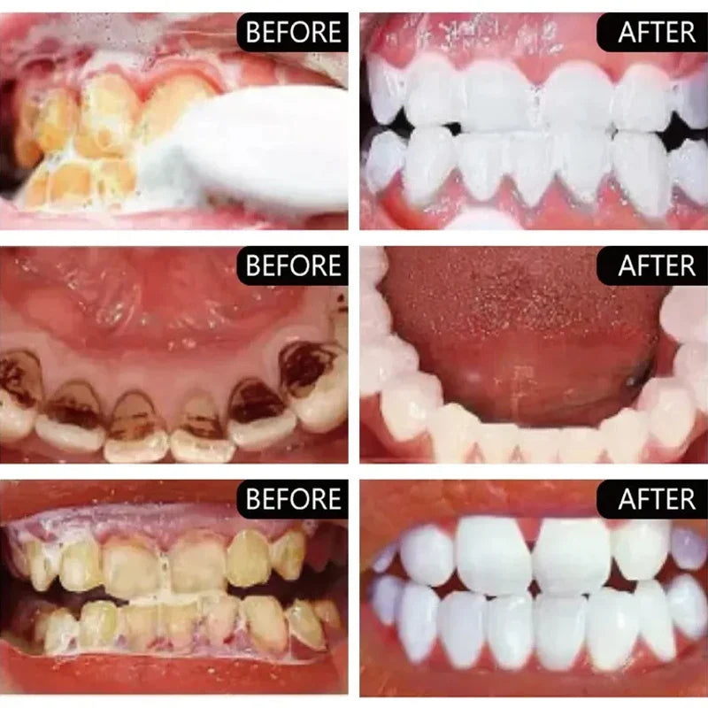 Teeth Whiten Toothpaste Fast Remove Plaque Smoke Coffee Tea Stains Clean Oral Hygiene Fresh Breath Bleaching