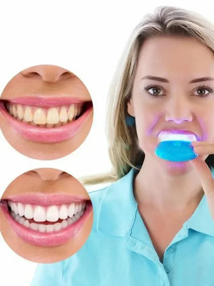 LED Blue Light Teeth Whitening Kit