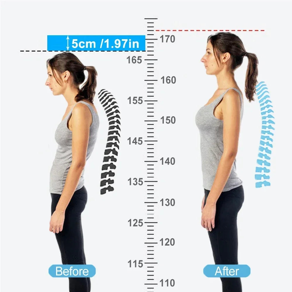 Smart Back Posture Correction Device Adjustable Back Smart Shoulder Support Belt Training Belt Spine Correction Back