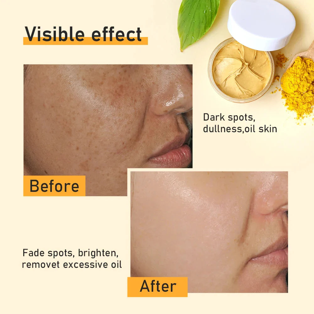 Turmeric Clay Mask Reduce Blackheads Clean Pores Soothe Acne Prone Skin Brightening Deep Cleaning Minimize Pores Skin Care 120g