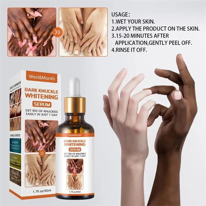 Dark Knuckles Whitening Serum Remover Get Rid of Dark Knees Dark Knuckle Elbow Cream Moisturizing Brighten Skin Tone Care