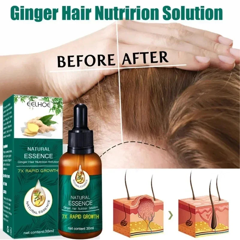 Hair Fast Growth Hair Care Essential Oil Natural Ginger Hairs Regrowth Products Serum