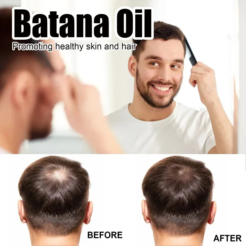 Natural Pure Batana Oil For Hair Growth Batana Oil Hair Oil Hair Loss Organic Batana Oil Hair Growth For Black Men & Women