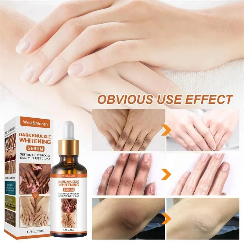 Dark Knuckles Whitening Serum Remover Get Rid of Dark Knees Dark Knuckle Elbow Cream Moisturizing Brighten Skin Tone Care